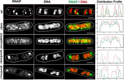 Extrachromosomal Nucleolus-Like Compartmentalization by a Plasmid-Borne Ribosomal RNA Operon and Its Role in Nucleoid Compaction